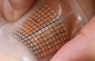 Early warning system for strokes and heart attacks using a soft and stretchy ultrasound skin patch