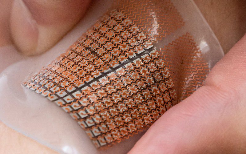This soft, stretchy skin patch uses ultrasound to monitor blood flow to organs like the heart and brain. This image was selected as the cover image for the July 2021 issue of Nature Biomedical Engineering.