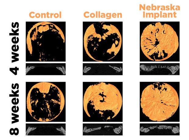 Adapted from figure in Science Advances / AAAS
A comparison of bone regeneration in groups receiving no treatment (left), a collagen sponge implant (center) and the radial scaffold developed by the Nebraska team (right).