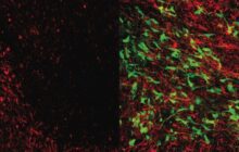 Researchers have successfully and reproducibly created clinical-grade transplantable brain cells in the lab