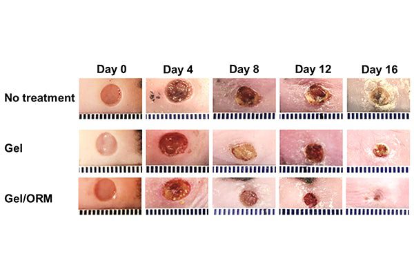 Representative images of the wounds treated with or without gel and oxygen-release microspheres for 16 days.