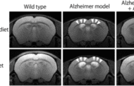 Could an essential amino acids supplement keep dementia at bay?