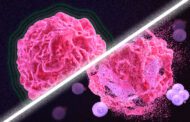 A new way to jump-start the immune system to attack tumors