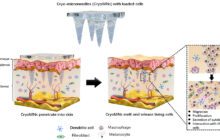 Ice microneedle patches just melt away for painless drug delivery