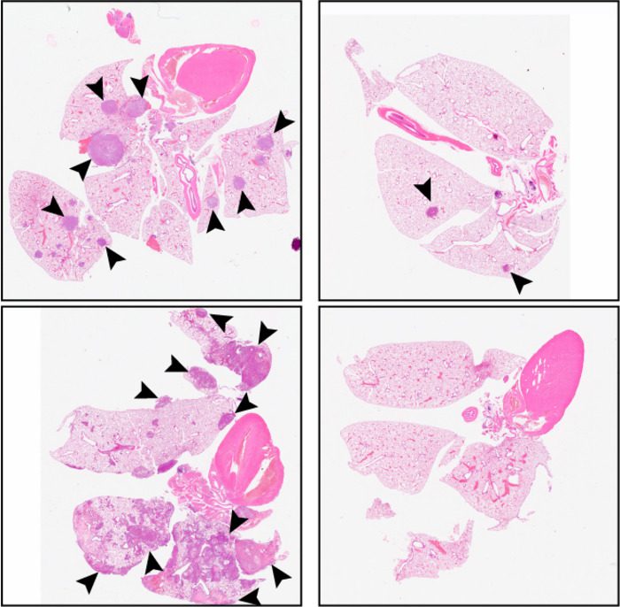 Compared with a control (left panels), C26 treatment (right panels) reduces the number of metastatic tumors in the lungs of mice injected with HSNCC cells.

CREDIT: Khalil et al. Originally published in Journal of Experimental Medicine. https://doi.org/10.1084/jem.20210836