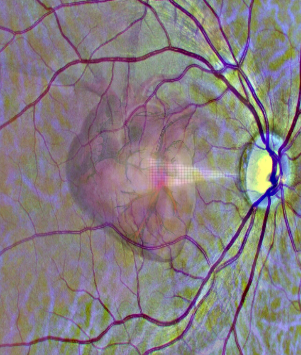 A graphical representation of the idea of using a scan of the eye to get a window into heart health.

CREDIT
University of Leeds