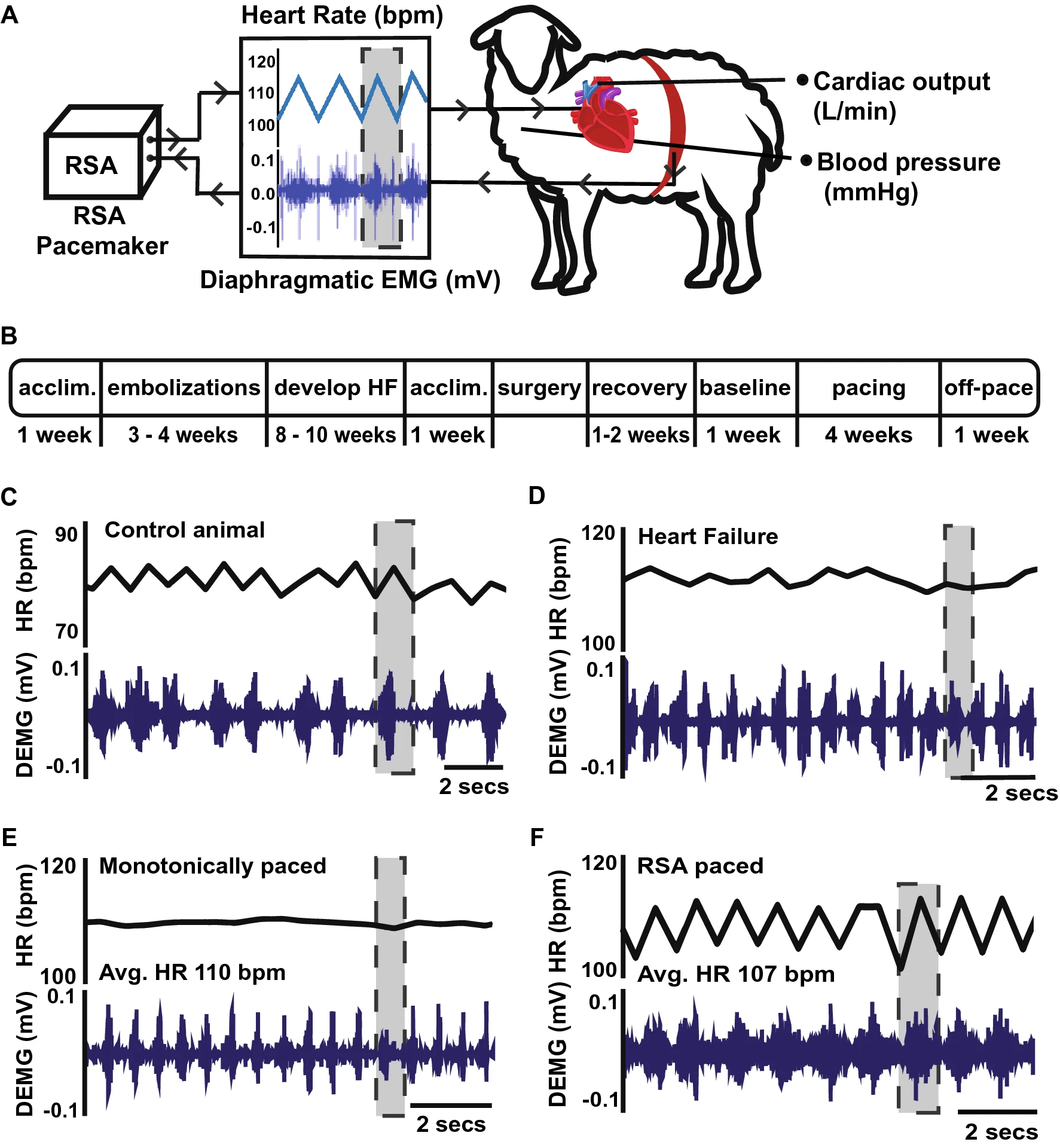 A. Schematic representation of the experimental set-up. Fully instrumented conscious 3–5 year old, outbred, female Romney sheep were paced via the left atrium, 1.5–2.5 V, using a neuron-based pace making device that modulates heart rate in phase with respiration on a breath by breath basis mimicking respiratory sinus arrhythmia (RSA). The device receives diaphragmatic EMG (electromyogram) input to define the phase of inspiration. RSA increases heart rate during inspiration as indicated by the highlighted regions in panels A, C–F Cardiac output was measured on a beat by beat basis using an implantable flow probe attached to the ascending aorta. B Time-line of the six-month experimental protocol. Heart failure with reduced ejection fraction was induced by microembolization and followed by an 8–10 week holding period for chronic heart failure to develop prior to pacing. Following instrumentation and stabilization of hemodynamics parameters, animals were divided into three groups: two were paced (RSA or monotonically) and one not paced (time control) for 4 weeks. This was followed by 1 week off pacing before animals were anaesthetized for baroreflex testing and cardiac tissue collected for post hoc analysis. C Representative raw data traces from a healthy sheep showing native RSA. D A heart failure sheep showing loss of RSA. E A heart failure sheep paced monotonically, showing a stable heart rate. F A heart failure sheep being RSA paced. Note that there was no difference between the mean heart rate of monotonically and RSA paced sheep. Acclim acclimatization to the laboratory; Avg. average; bpm, beats per minute; DEMG diaphragmatic electromyogram; HR heart rate; mV milli Volts