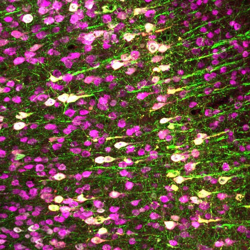 Neurons (magenta) in the mouse brain. The Chalasani lab made specific neurons express TRPA1 (white), so they can be activated by ultrasound.

Credit: Salk Institute