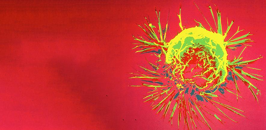Breast Cancer Cell Credit: NIH Image Gallery