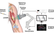 Could direct sound printing revolutionize 3D printing and enable remote in-body printing for humans and other animals?