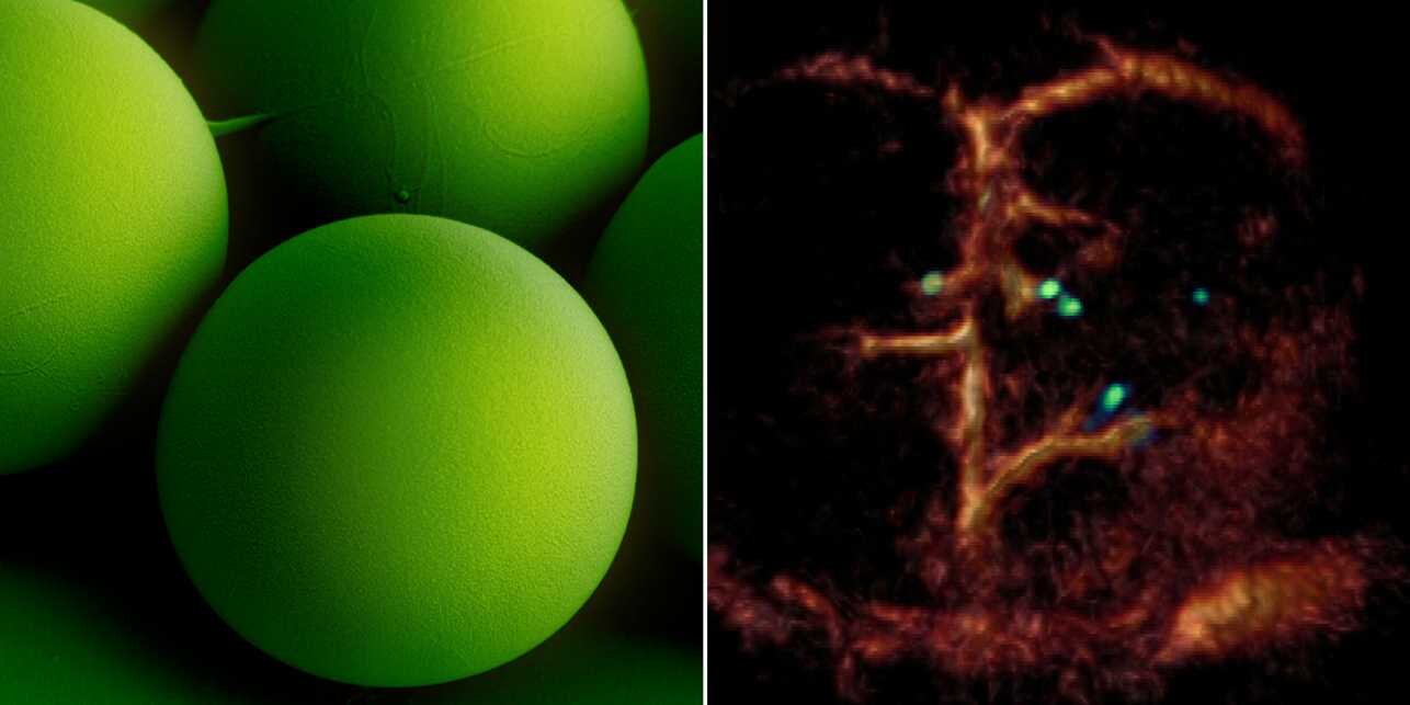 A breakthrough: Tiny circulating microrobots, which are as small as red blood cells (left picture), were visualised one-?by-one in the blood vessels of mice with optoacoustic imaging (right picture). (Image: ETH Zurich / Max Planck Institute for Intelligent Systems)