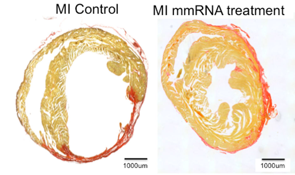 Figure shows an example of a repair of an infarcted adult mouse heart in vivo, made possible through injections of a combination of STEMIN and YAP5SA mRNA. After four weeks, sectioned hearts stained red showed significant reduction of infarcted area (photo credit: The Journal of Cardiovascular Aging)