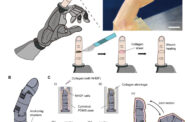 A controllable robotic finger covered with living skin tissue
