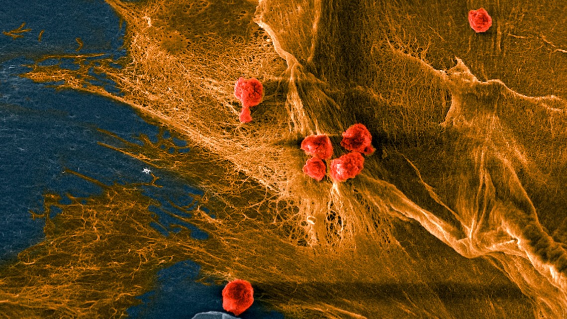Bouklas Lab/Provided Micrograph of a biohybrid composite material developed at Cornell shows cells (red) seeded on the fibrous domains (yellow) of collagen. The material mimics natural tissue in its softness, toughness, and ability to recruit cells and keep them alive.