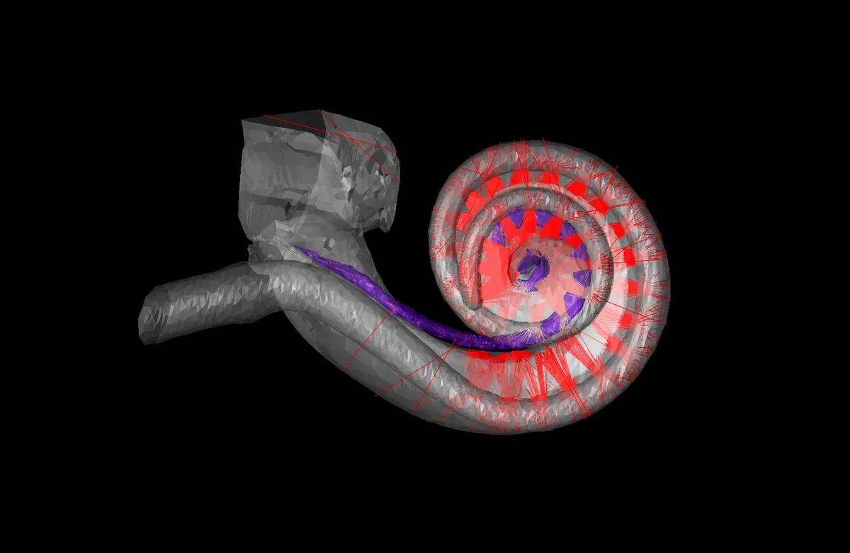 Human hearing depends on the cochlea, a snail-shaped structure in the inner ear. A new kind of cochlear implant for people with disabling hearing loss would use beams of light to stimulate the cochlear nerve. LAKSHAY KHURANA AND DANIEL KEPPELER
