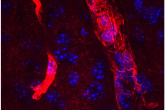 DARSHAN SAPKOTA An extended form of the protein aquaporin 4 (red) lines the edges of tiny blood vessels in the brain. Cell nuclei are visible in blue. Researchers at Washington University School of Medicine in St. Louis have found a new druggable pathway that enhances the amount of long aquaporin 4 near blood vessels and increases the clearance of waste from the brain. The findings potentially could lead to new therapies to prevent Alzheimer’s dementia.