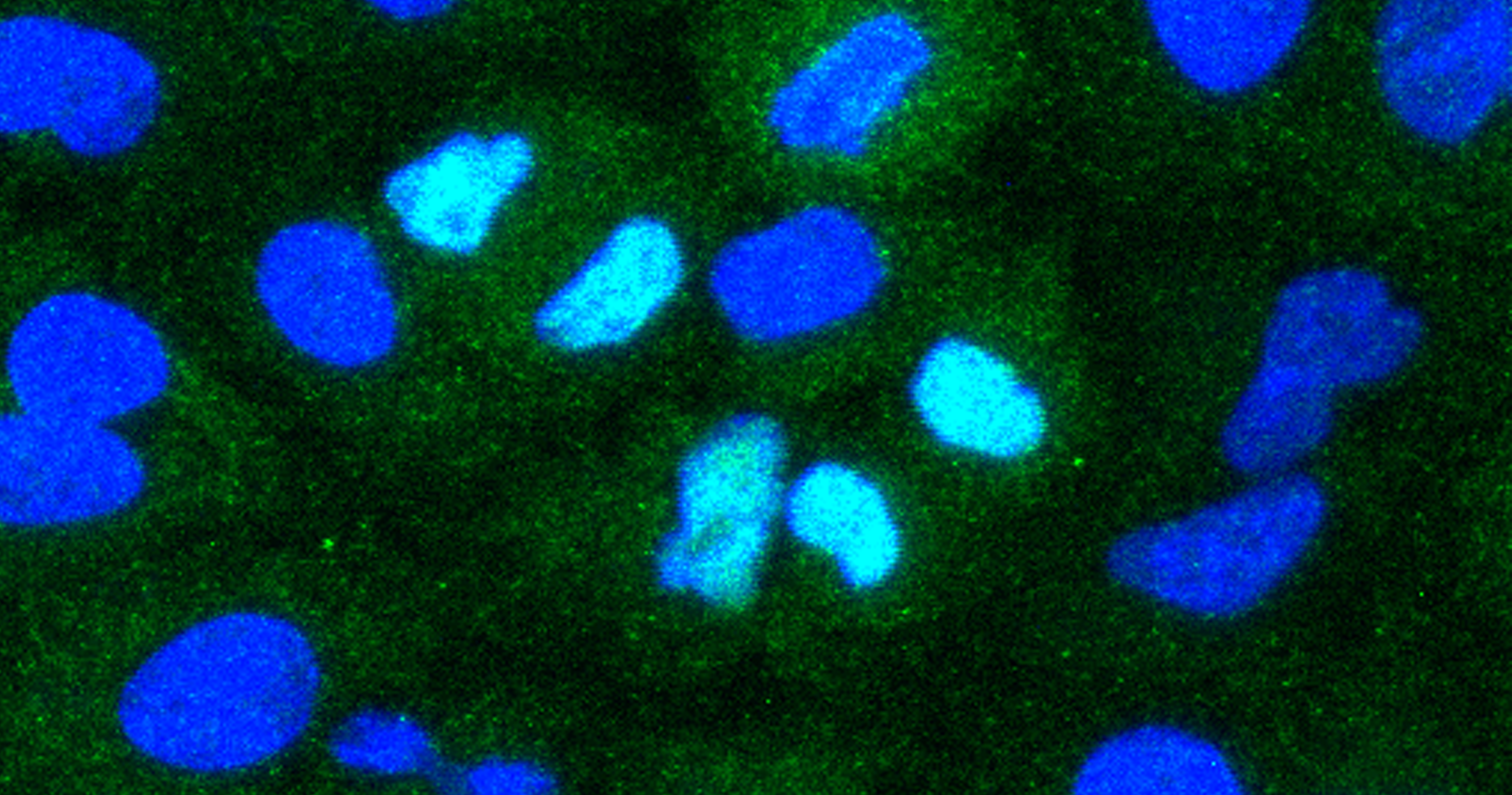 The introduction of the novel dsRNAs into living cells induces IFN-I production in cells’ nuclei (right, in light blue), while the introduction of scrambled control dsRNA does not (left). Credit: Wyss Institute at Harvard University