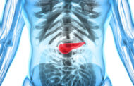 A radioactive tumor implant has been shown to obliterate pancreatic cancer in mice