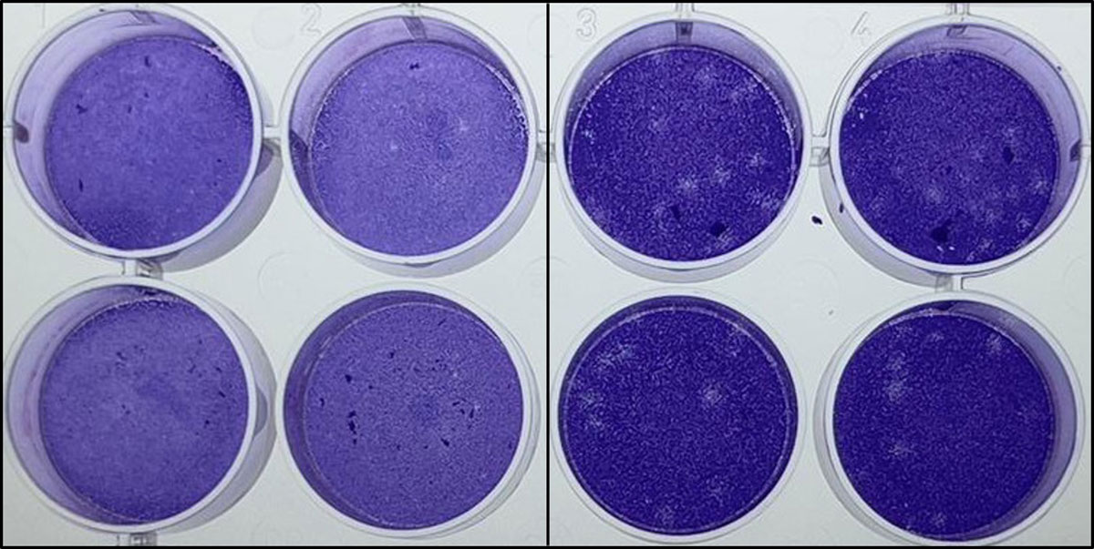 Cells treated with the compound (right) showed reduced infection from the Omicron variant compared to untreated cells (left). (Photo credit: Dr. Selvarani Vimalanathan, Molecular Biomedicine)