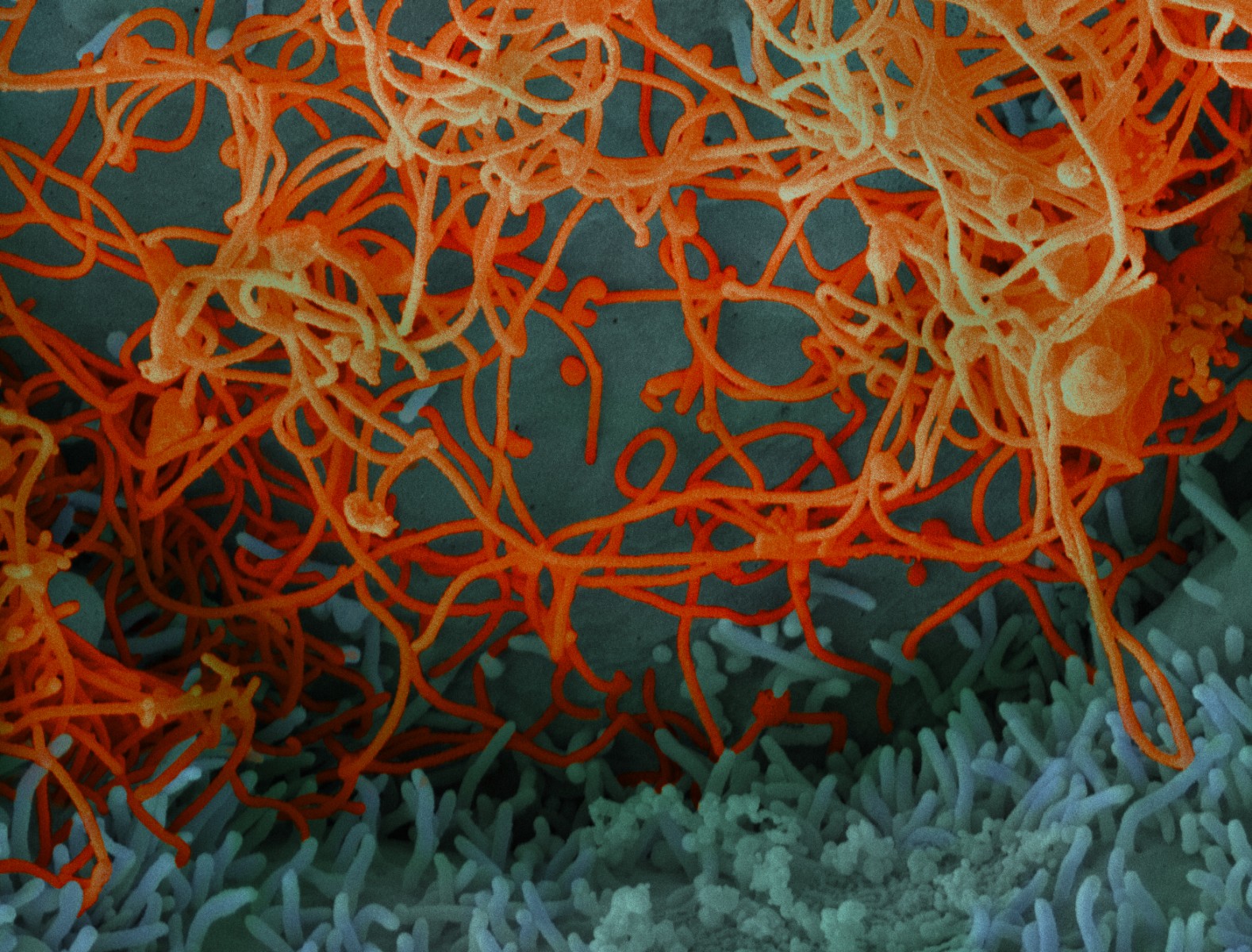 “Repeat offender” virus families that may pose higher risk to humans include filoviruses like Ebola, seen in this image of the virus isolated from patient blood samples in Mali. Image: National Institute of Allergy and Infectious Diseases