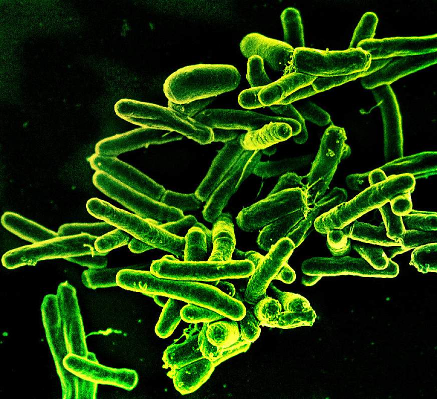 Scanning electron micrograph of Mycobacterium tuberculosis bacteria, which cause TB.NIAID