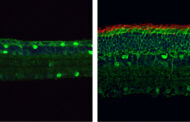 Researchers have successfully restored the vision of mice with retinitis pigmentosa