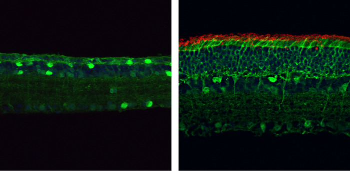 By the age of four months, the retinas of mice carrying a mutation in the gene encoding PDE6? (left) are thin and lack rod photoreceptors (red). But mice who have had this mutation corrected through the PESpRY system (right) have much thicker retinas containing numerous rod cells. CREDIT © 2023 Qin et al. Originally published in Journal of Experimental Medicine. https://doi.org/10.1084/jem.20220776