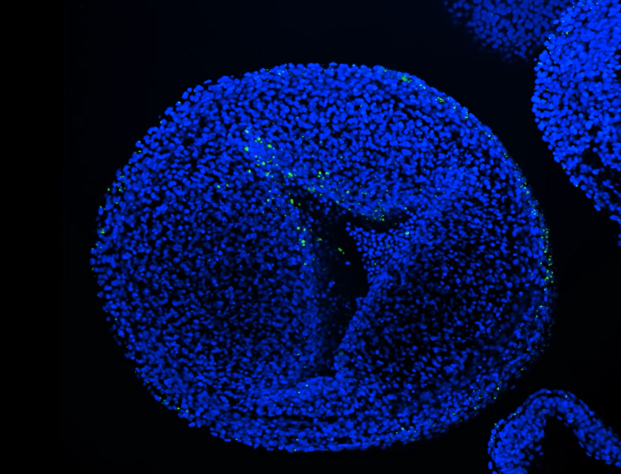 Fluorescent nano-plastics (green) target the cell (blue). By Meiru Wang and Gerda Lamers