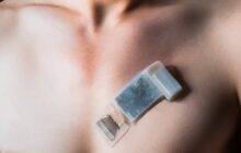 Wireless ultrasound for deep-tissue cardiac monitoring while moving
