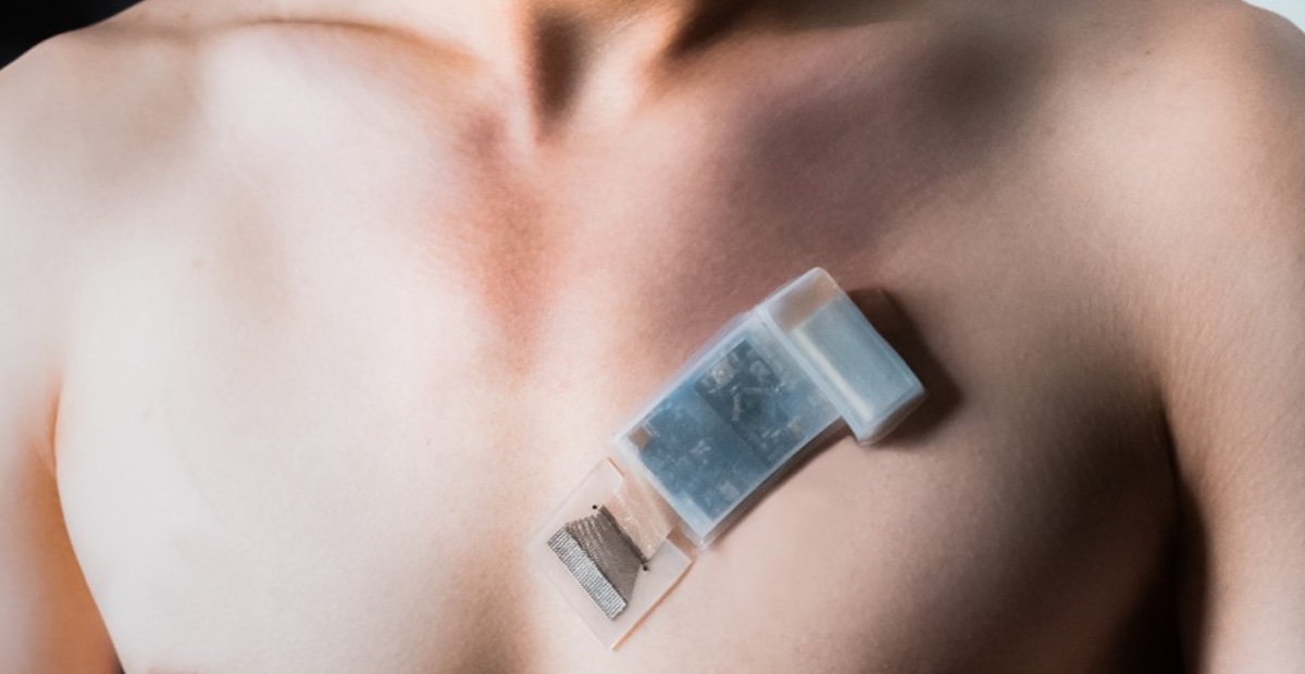 A wearable ultrasonic-system-on-patch mounted on the chest for measuring cardiac activity. Photo by Muyang Lin for the Jacobs School of Engineering at UC San Diego.